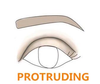 saliente protruding